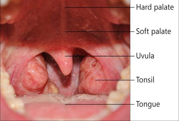 Throat Cancer Symptoms Throat Cancer Symptoms